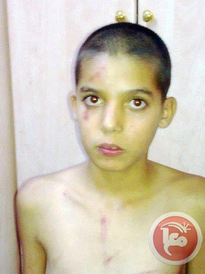 Les forces israéliennes attaquent un mineur de Jérusalem Est